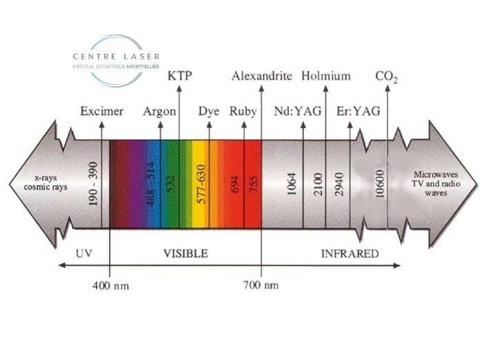 Les différents types de laser en épilation définitive.