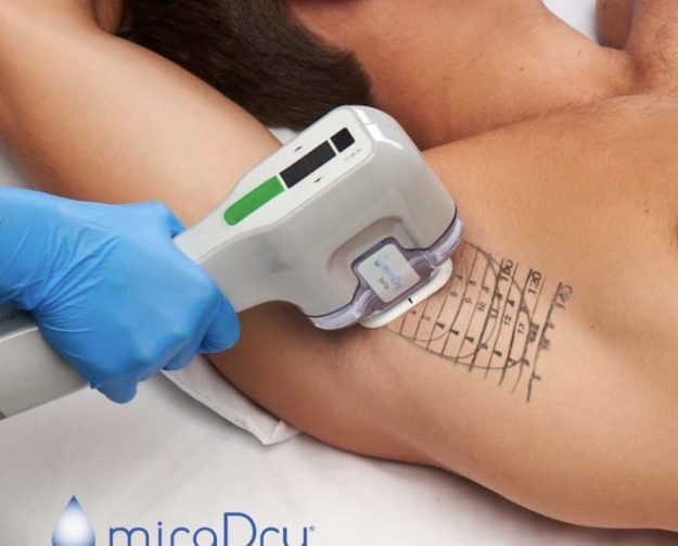 Traitement miraDry - centrelasermontpellier